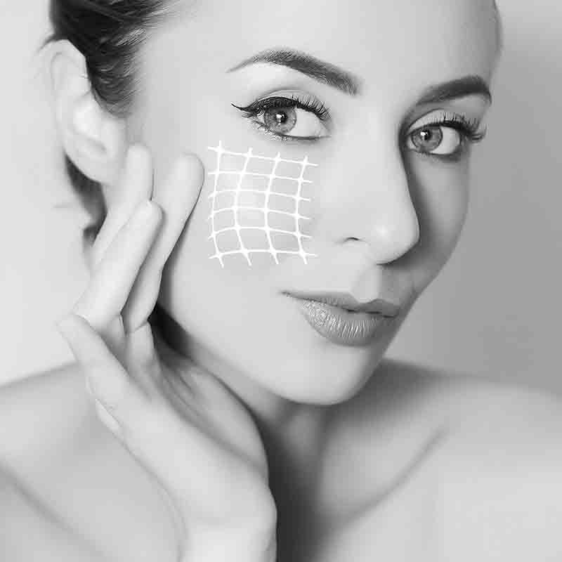 Facelift - Dr. Mazarro