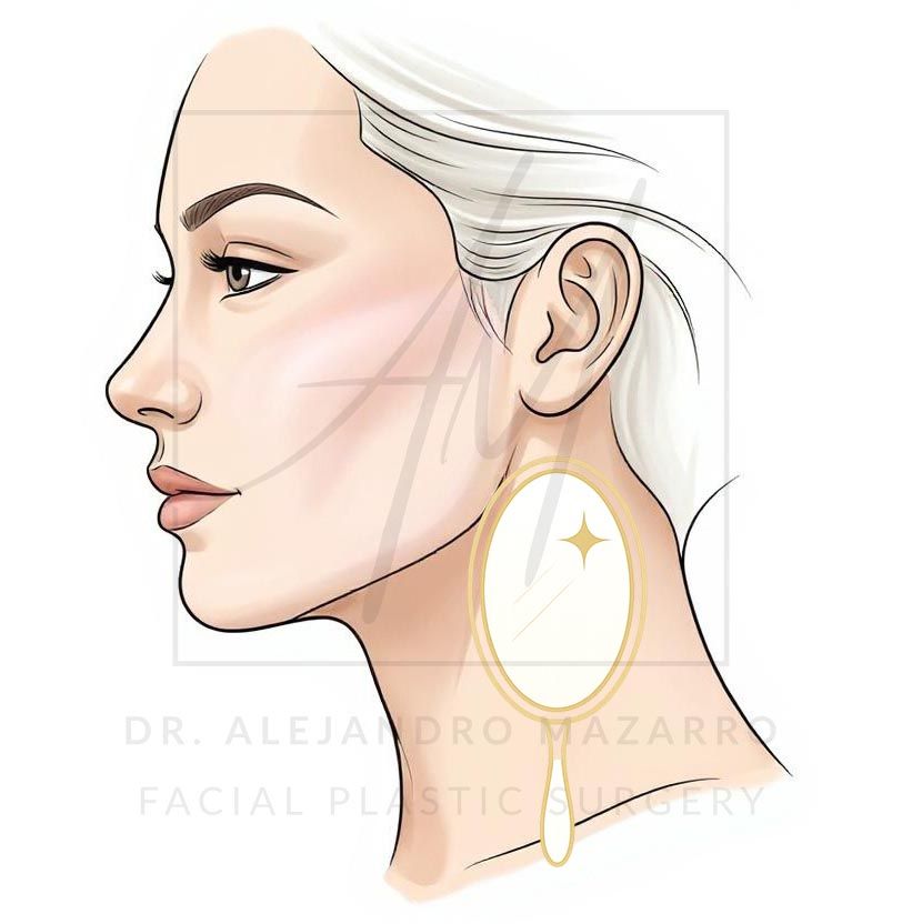Resultados de un lifting facial