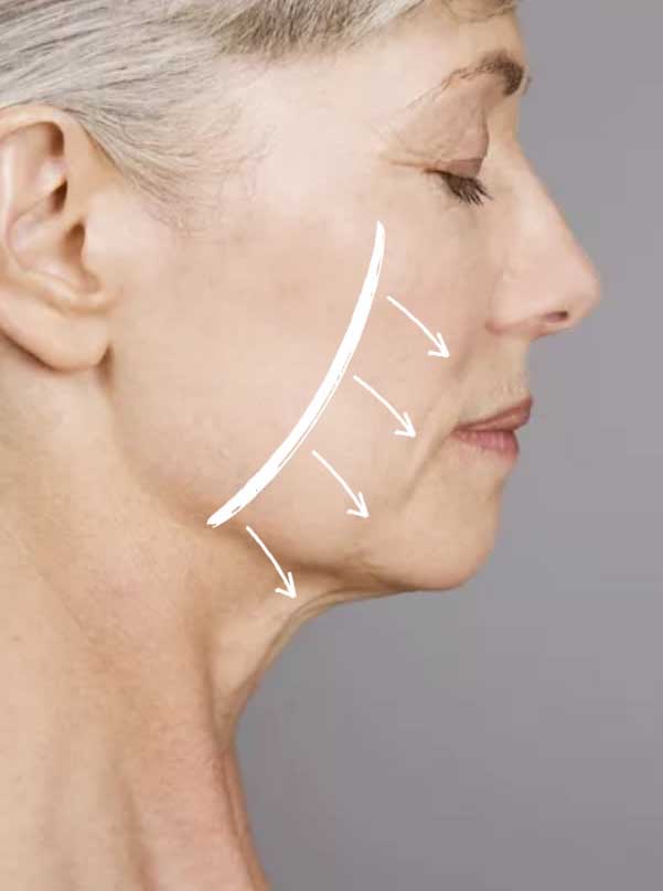 Caída de los tejidos faciales con el tiempo