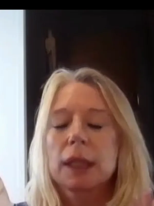 Bethan, Deep Plane Facelift: What was your biggest fear?
