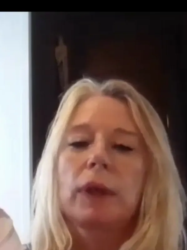 Bethan, Deep Plane Facelift: What was your recovery like?