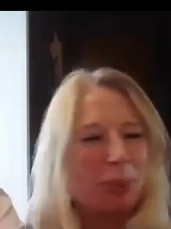 Bethan, Deep Plane Facelift: Can people tell you’ve had surgery?