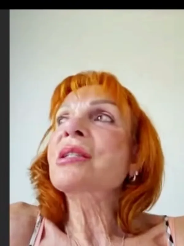 Elaine, Deep Plane Facelift: How do you feel about your results?