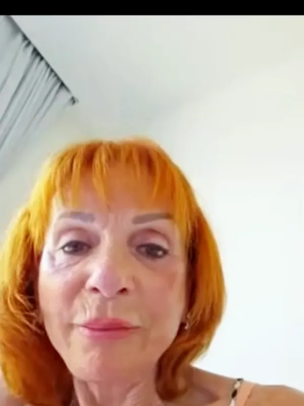 Elaine, Deep Plane Facelift: How has surgery changed how you feel?