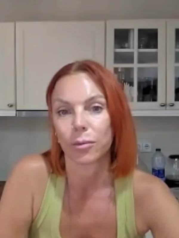 Lauren, Deep Plane Facelift: Was your recovery painful?