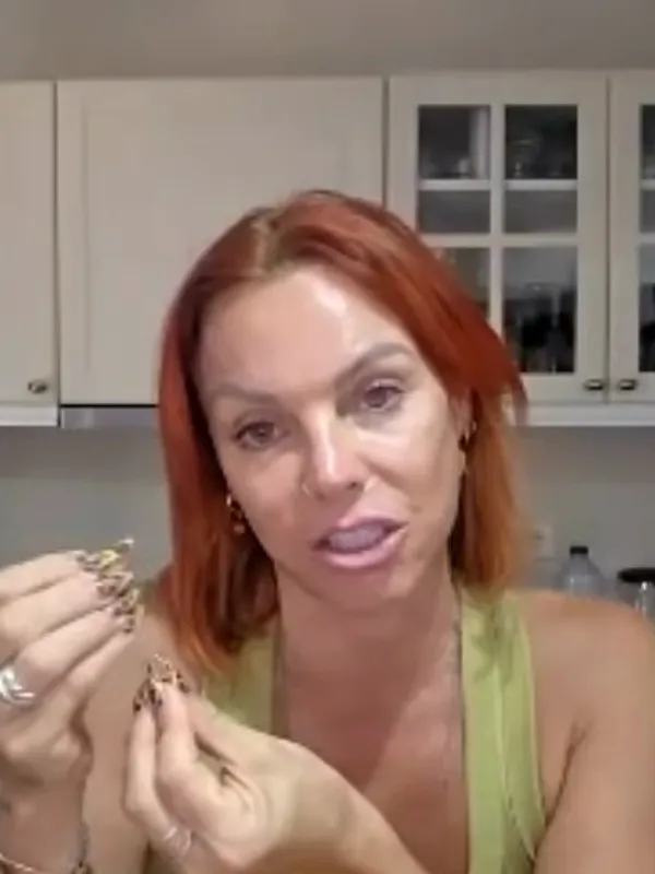 Lauren, Deep Plane Facelift: What do your scars look like now?