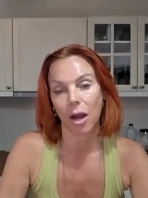 Lauren, Deep Plane Facelift: Can people tell you’ve had surgery?