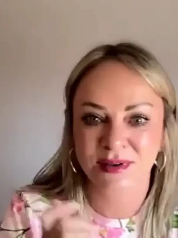 Lisa, Deep Plane Facelift: How was your recovery?