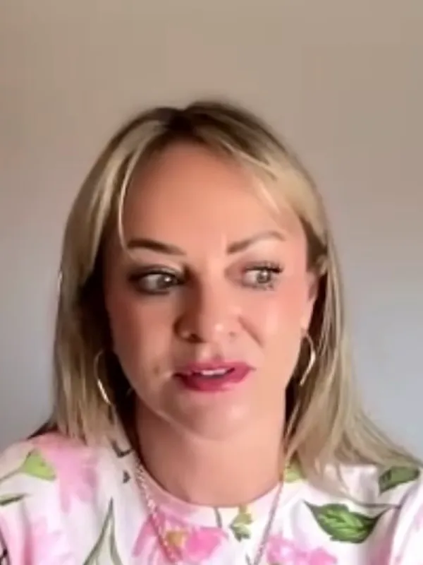 Lisa, Deep Plane Facelift: Postoperative care