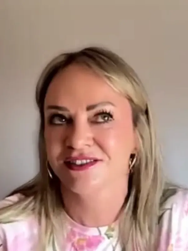 Lisa, Deep Plane Facelift: Before & after: the reaction