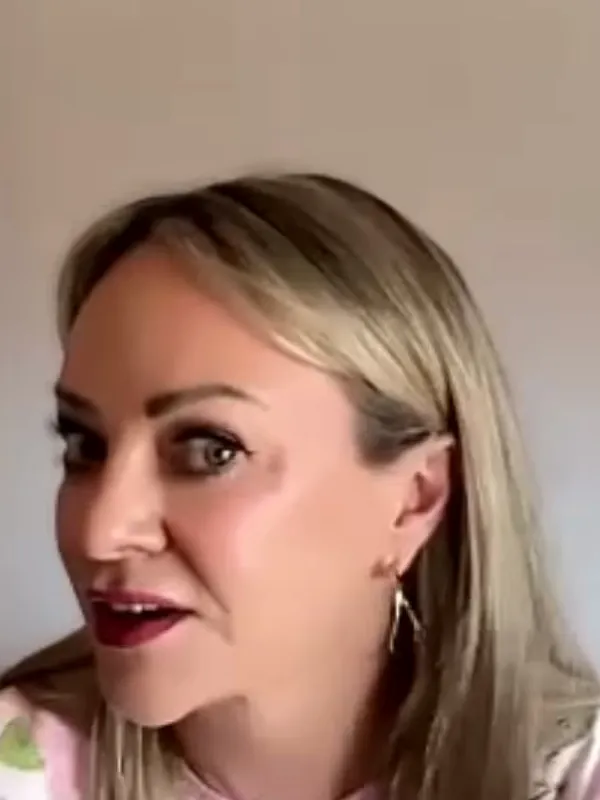 Lisa, Deep Plane Facelift: Can people tell you’ve had surgery?