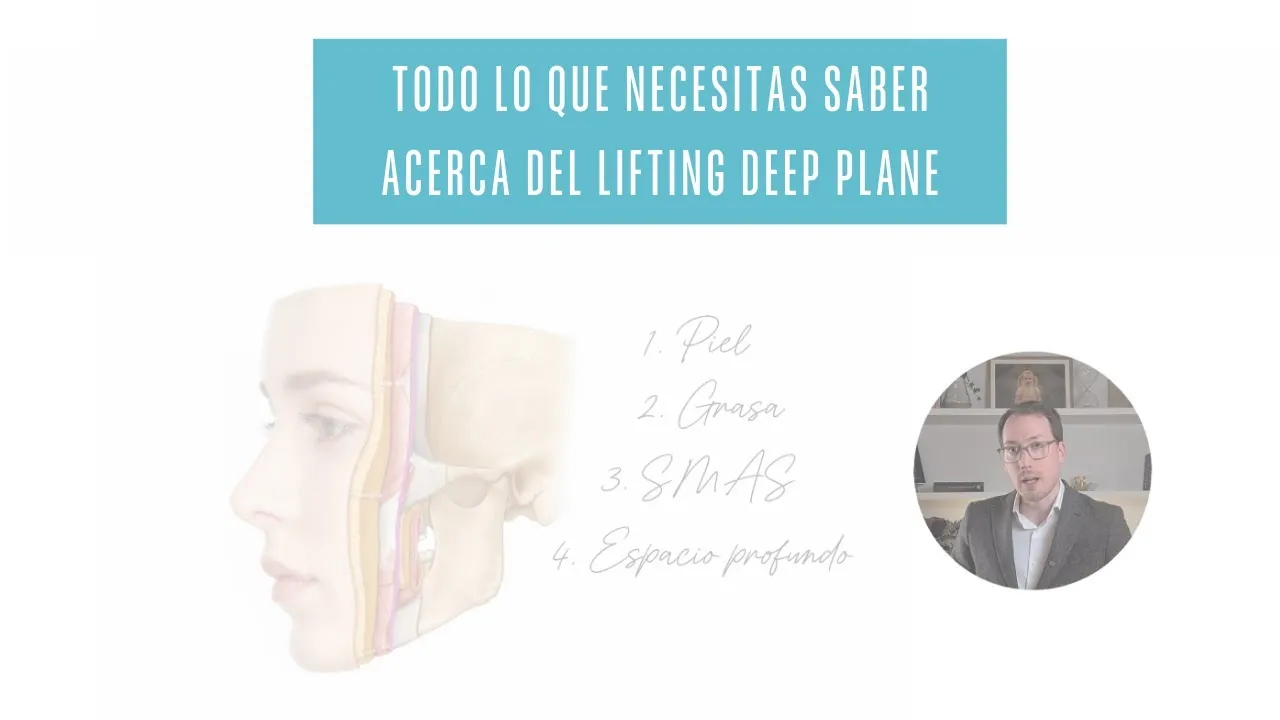 Todo lo que necesitas saber acerca del Lifting Deep Plane